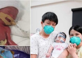 World's ‘smallest baby’ returns home after spending 13 months in hospital