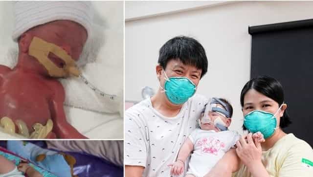 World's ‘smallest baby’ returns home after spending 13 months in hospital