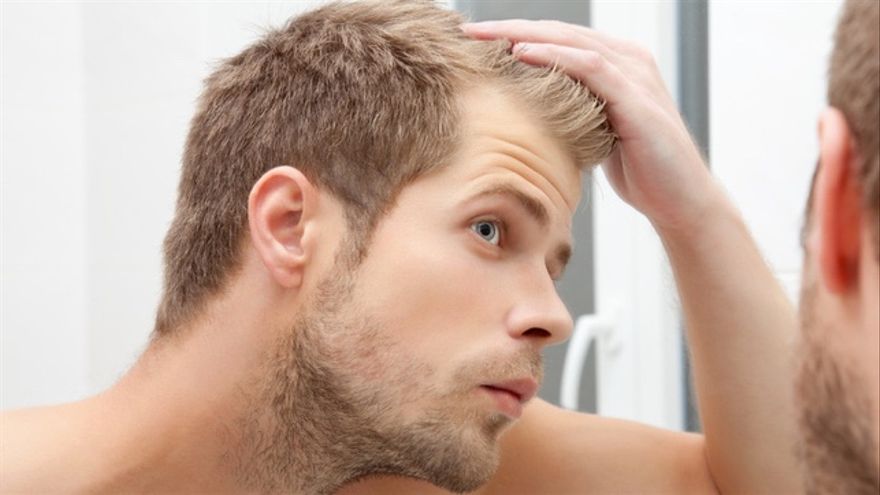 Wiohair: tratamiento anticaída para el cabello