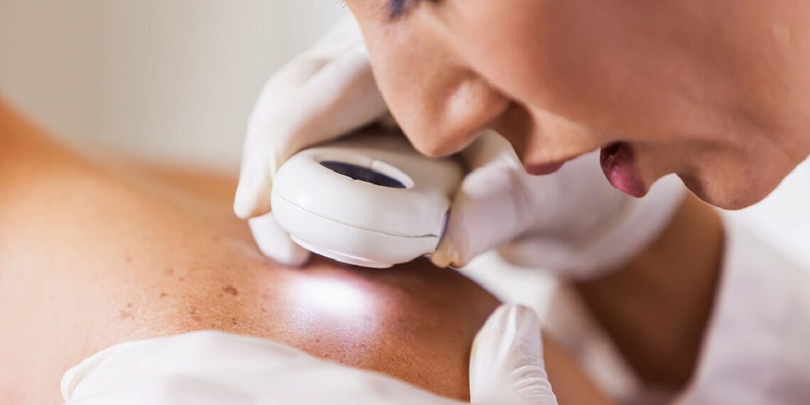 Razones para acudir a un dermatólogo: ¡Tu piel lo agradecerá!