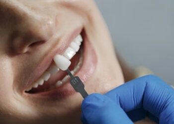 Las carillas no solo mejoran la estética, sino que contribuyen con la buena salud bucal
